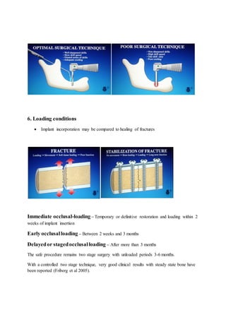 6. Loading conditions
 Implant incorporation may be compared to healing of fractures
Immediate occlusal-loading – Temporary or definitive restoration and loading within 2
weeks of implant insertion
Early occlusalloading – Between 2 weeks and 3 months
Delayedor stagedocclusalloading – After more than 3 months
The safe procedure remains two stage surgery with unloaded periods 3-6 months.
With a controlled two stage technique, very good clinical results with steady state bone have
been reported (Friberg et al 2005).
 
