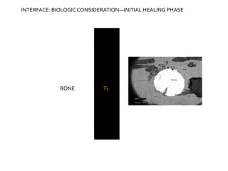 BONE Ti
INTERFACE: BIOLOGICCONSIDERATION—INITIAL HEALING PHASE
 