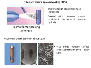 Titanium plasma sprayed coating (TPS)
The first rough titanium surface
introduced
Coated with titanium powder
particles in the form of titanium
hydride
Plasma flame spraying
technique
 6-10 times increase surface
area. Steinemann 1988, Tetsch
1991
Roughness Depth profile of about 15m
 