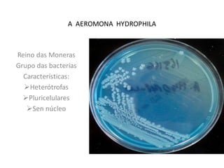 A AEROMONA HYDROPHILA

Reino das Moneras
Grupo das bacterias
Características:
Heterótrofas
Pluricelulares
Sen núcleo

 