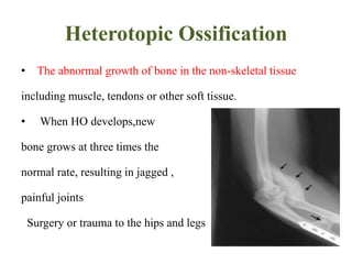 Heterotopic Ossification
• The abnormal growth of bone in the non-skeletal tissue
including muscle, tendons or other soft tissue.
• When HO develops,new
bone grows at three times the
normal rate, resulting in jagged ,
painful joints
Surgery or trauma to the hips and legs
 