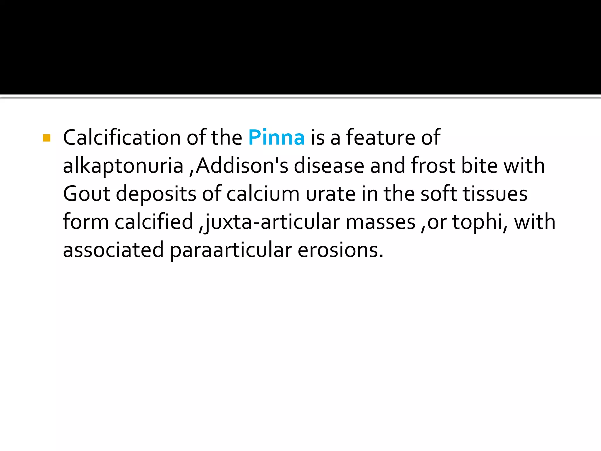  Calcification of the Pinna is a feature of
alkaptonuria ,Addison's disease and frost bite with
Gout deposits of calcium urate in the soft tissues
form calcified ,juxta-articular masses ,or tophi, with
associated paraarticular erosions.
 