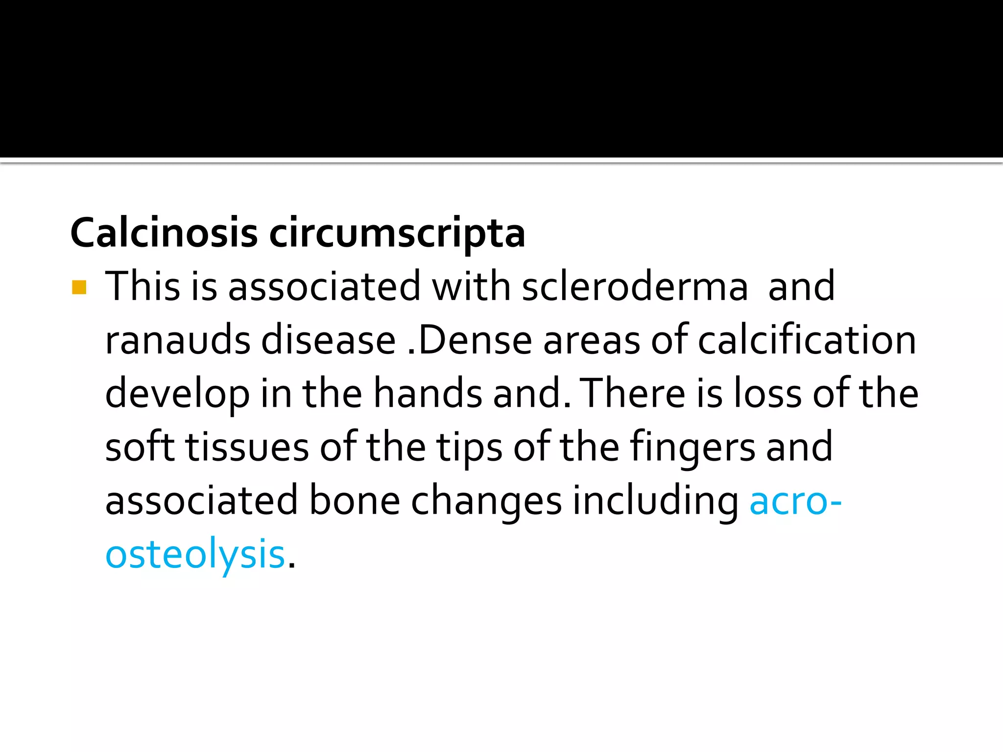 Calcinosis circumscripta
 This is associated with scleroderma and
ranauds disease .Dense areas of calcification
develop in the hands and.There is loss of the
soft tissues of the tips of the fingers and
associated bone changes including acro-
osteolysis.
 