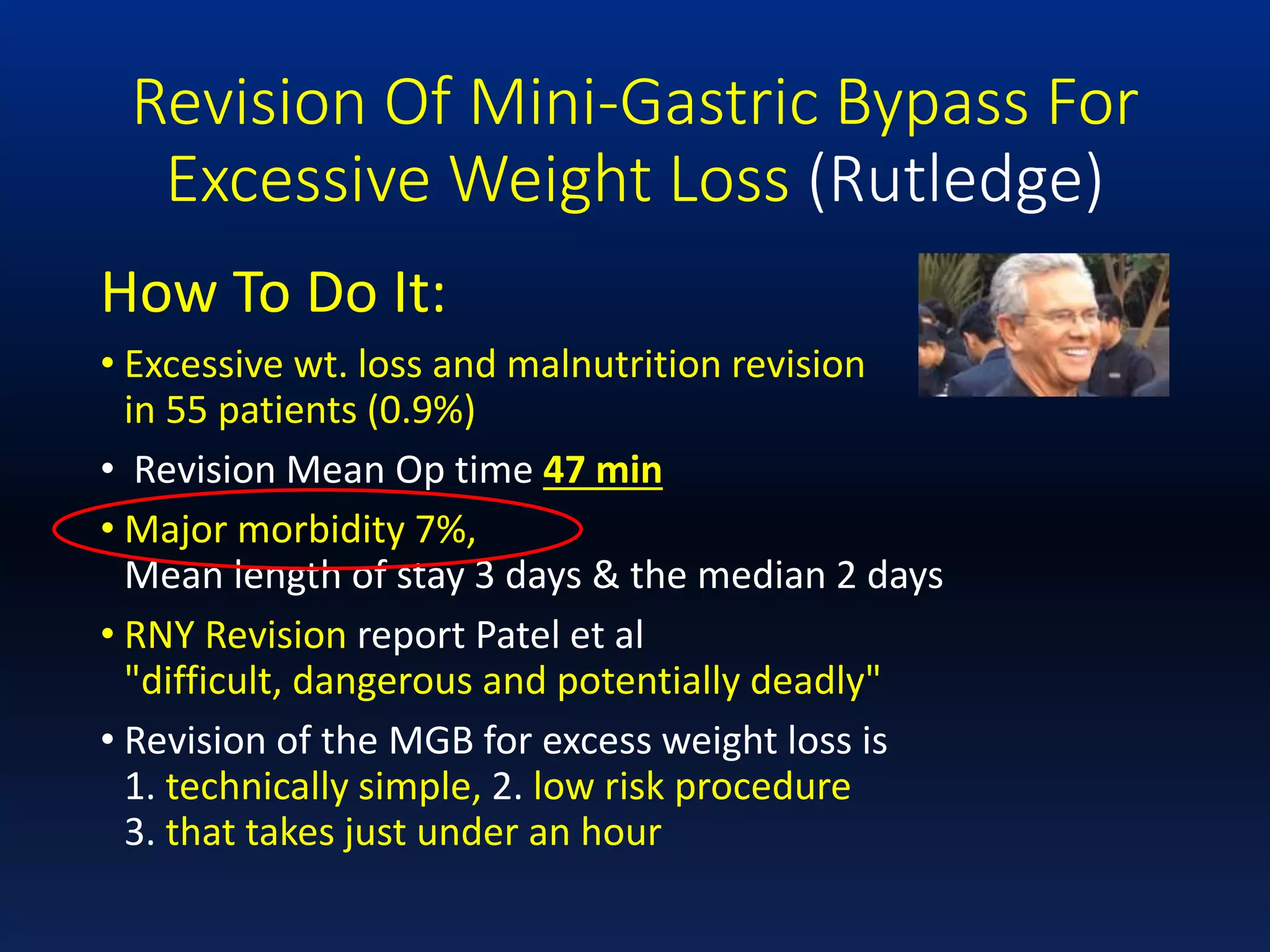 Revision Of Mini-Gastric Bypass For
Excessive Weight Loss (Rutledge)
How To Do It:
• Excessive wt. loss and malnutrition revision
in 55 patients (0.9%)
• Revision Mean Op time 47 min
• Major morbidity 7%,
Mean length of stay 3 days & the median 2 days
• RNY Revision report Patel et al
"difficult, dangerous and potentially deadly"
• Revision of the MGB for excess weight loss is
1. technically simple, 2. low risk procedure
3. that takes just under an hour
 