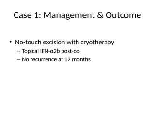 Case 1: Management & Outcome
• No-touch excision with cryotherapy
– Topical IFN-α2b post-op
– No recurrence at 12 months
 