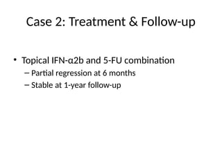Case 2: Treatment & Follow-up
• Topical IFN-α2b and 5-FU combination
– Partial regression at 6 months
– Stable at 1-year follow-up
 