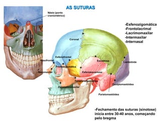 AS SUTURAS
Coronal
*
Lambdóide
*
Escamosa
*
Occiptomastóidea
*
Esfenoescamosa
*
Esfenofrontal
*
Temporozigomática
*
Frontozigomática
*
Zigomaticomaxilar
*
-Esfenozigomática
-Frontolacrimal
-Lacrimomaxilar
-Intermaxilar
-Internasal
Nasomaxilar
*
Nasofrontal
*
-Fechamento das suturas (sinotose)
inicia entre 30-40 anos, começando
pelo bregma
Parietomastóidea
*
Násio (ponto
craniométrico)
 