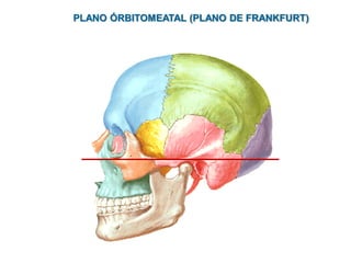 PLANO ÓRBITOMEATAL (PLANO DE FRANKFURT)
 