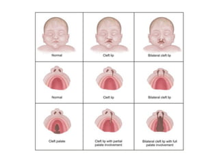 ossos-crânio-EEFE-2013.pdf