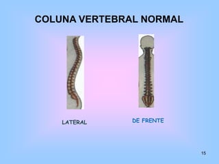 Tipos de ossosQuanto à forma os ossos podem classificar-se em:Ossoslongos:a dimensãopredominante é o comprimento e o osso é espesso. Exemplo: fémur ... Ossoschatos:a superfície é grande, mas a espessura é pequena.Exemplo: ossosilíacos ...Ossoscurtos:nãoháumadimensãoque, nitidamente, Predominesobre as outras.Exemplo: rótula ... 