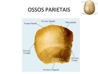 OSSOS PARIETAIS
 