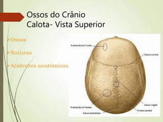 Ossos do Crânio
Calota- Vista Superior
Ossos
Suturas
Acidentes anatômicos
 
