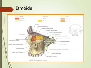 Etmóide
 