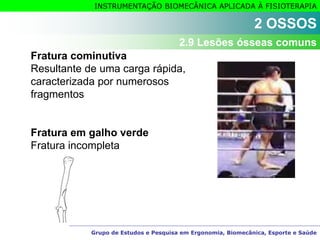 Grupo de Estudos e Pesquisa em Ergonomia, Biomecânica, Esporte e Saúde
INSTRUMENTAÇÃO BIOMECÂNICA APLICADA À FISIOTERAPIA
Fratura cominutiva
Resultante de uma carga rápida,
caracterizada por numerosos
fragmentos
Fratura em galho verde
Fratura incompleta
2 OSSOS
2.9 Lesões ósseas comuns
 
