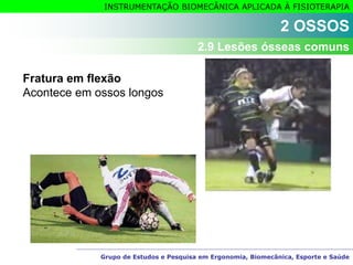 Grupo de Estudos e Pesquisa em Ergonomia, Biomecânica, Esporte e Saúde
INSTRUMENTAÇÃO BIOMECÂNICA APLICADA À FISIOTERAPIA
Fratura em flexão
Acontece em ossos longos
2 OSSOS
2.9 Lesões ósseas comuns
 