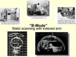 “B-Mode”
Static scanning with indexed arm
 