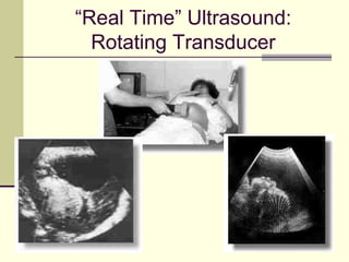 81
“Real Time” Ultrasound:
Rotating Transducer
 