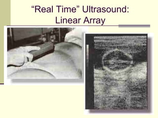 82
“Real Time” Ultrasound:
Linear Array
 