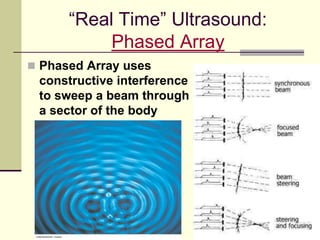 83
“Real Time” Ultrasound:
Phased Array
 Phased Array uses
constructive interference
to sweep a beam through
a sector of the body
 