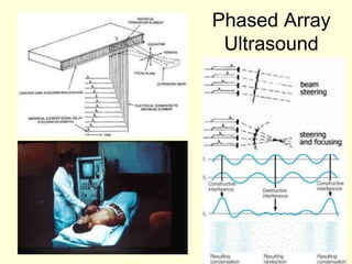 84
Phased Array
Ultrasound
 