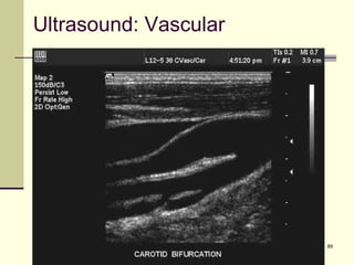 89
Ultrasound: Vascular
 