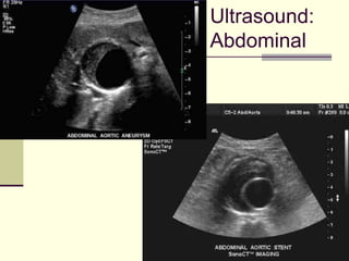 90
Ultrasound:
Abdominal
 