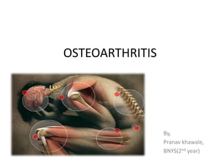 OSTEOARTHRITIS




                 By,
                 Pranav khawale,
                 BNYS(2nd year)
 