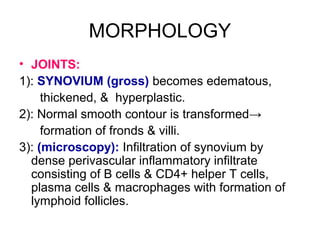 MORPHOLOGY
• JOINTS:
1): SYNOVIUM (gross) becomes edematous,
thickened, & hyperplastic.
2): Normal smooth contour is transformed→
formation of fronds & villi.
3): (microscopy): Infiltration of synovium by
dense perivascular inflammatory infiltrate
consisting of B cells & CD4+ helper T cells,
plasma cells & macrophages with formation of
lymphoid follicles.
 