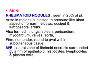 • SKIN:
RHEUMATOID NODULES : seen in 25% of pt.
Arise in regions subjected to pressure like ulnar
aspect of forearm, elbows, occiput &
lumbosacral areas.
Also formed in lungs, spleen, pericardium,
myocardium, valves, aorta,
Firm, nontender, round to oval within
subcutaneous tissue
M/E: central zone of fibrinoid necrosis surrounded
by a rim of epithelioid histiocytes, lymphocytes
& plasma cells.
 