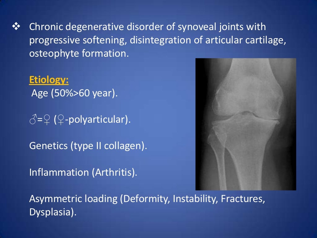orthopedics.Osteoarthritis.(dr.ariwan)