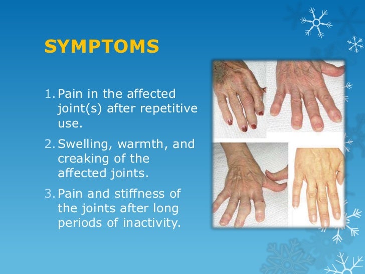 Osteoarthritis