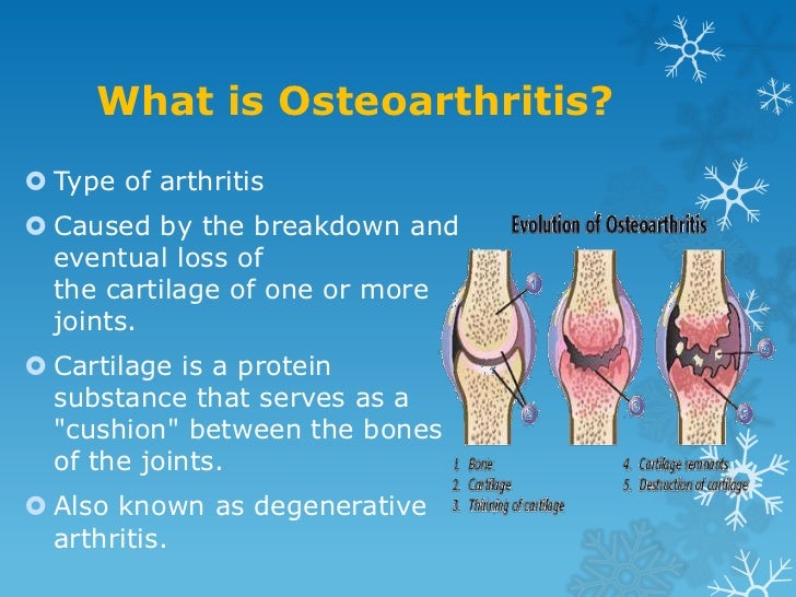 Osteoarthritis