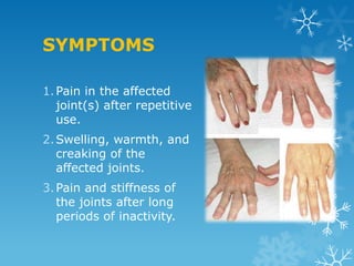 SYMPTOMS

1. Pain in the affected
   joint(s) after repetitive
   use.
2. Swelling, warmth, and
   creaking of the
   affected joints.
3. Pain and stiffness of
   the joints after long
   periods of inactivity.
 