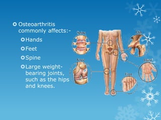  Osteoarthritis
  commonly affects:-
  Hands
  Feet
  Spine
  Large weight-
   bearing joints,
   such as the hips
   and knees.
 
