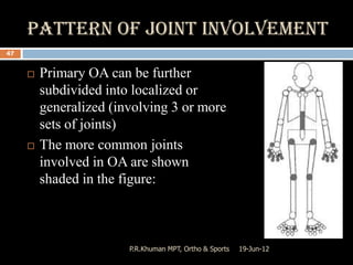 Osteoarthritis | PPTX