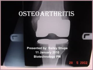 Osteoarthritis Presented by: Bailey Shupe 11 January 2010 Biotechnology PM 