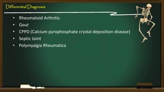 Differential Diagnosis

•
•
•
•
•

Rheumatoid Arthritis
Gout
CPPD (Calcium pyrophosphate crystal deposition disease)
Septic Joint
Polymyalgia Rheumatica

 