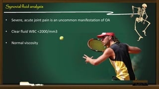 Synovial fluid analysis
•

Severe, acute joint pain is an uncommon manifestation of OA

•

Clear fluid WBC <2000/mm3

•

Normal viscosity

 