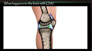 What happens to the knee with OA?

 