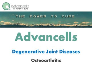 Advancells
Degenerative Joint Diseases
Osteoarthritis
 