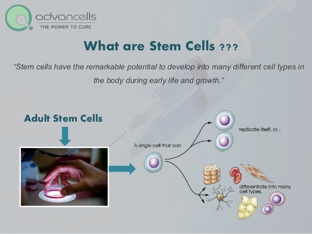 Osteoarthritis Treatment Stem Cell Treatment for