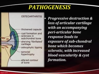 PATHOGENESIS
• Progressive destruction &
loss of articular cartilage
with an accompanying
peri-articular bone
response leads to
exposure of sub-chondral
bone which becomes
sclerotic, with increased
blood vascularity & cyst
formation.
 
