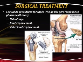SURGICAL TREATMENT
• Should be considered for those who do not give response to
pharmacotherapy.
– Osteotomy.
– Joint replacement.
– Total joint replacement.
 