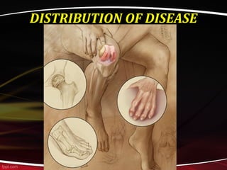 DISTRIBUTION OF DISEASE
 