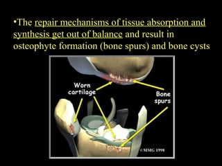 •The repair mechanisms of tissue absorption and
synthesis get out of balance and result in
osteophyte formation (bone spurs) and bone cysts
 