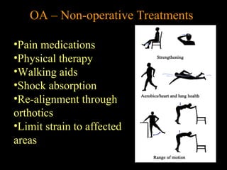OA – Non-operative Treatments
•Pain medications
•Physical therapy
•Walking aids
•Shock absorption
•Re-alignment through
orthotics
•Limit strain to affected
areas
 