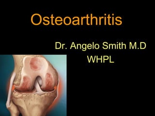 Osteoarthritis
Dr. Angelo Smith M.D
WHPL
 