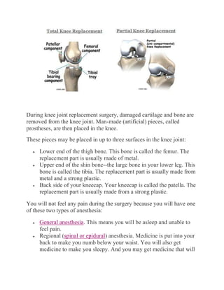 During knee joint replacement surgery, damaged cartilage and bone are
removed from the knee joint. Man-made (artificial) pieces, called
prostheses, are then placed in the knee.
These pieces may be placed in up to three surfaces in the knee joint:
 Lower end of the thigh bone. This bone is called the femur. The
replacement part is usually made of metal.
 Upper end of the shin bone--the large bone in your lower leg. This
bone is called the tibia. The replacement part is usually made from
metal and a strong plastic.
 Back side of your kneecap. Your kneecap is called the patella. The
replacement part is usually made from a strong plastic.
You will not feel any pain during the surgery because you will have one
of these two types of anesthesia:
 General anesthesia. This means you will be asleep and unable to
feel pain.
 Regional (spinal or epidural) anesthesia. Medicine is put into your
back to make you numb below your waist. You will also get
medicine to make you sleepy. And you may get medicine that will
 