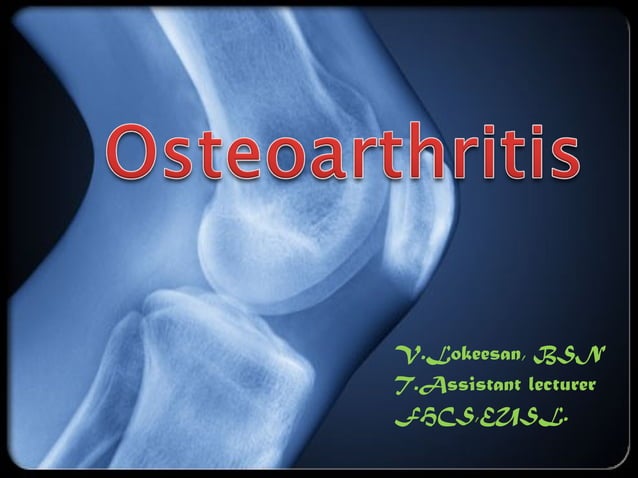 Osteoarthritis | PPT