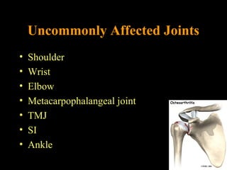Uncommonly Affected Joints
• Shoulder
• Wrist
• Elbow
• Metacarpophalangeal joint
• TMJ
• SI
• Ankle
 